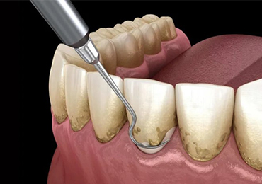 Restorative Dentistry